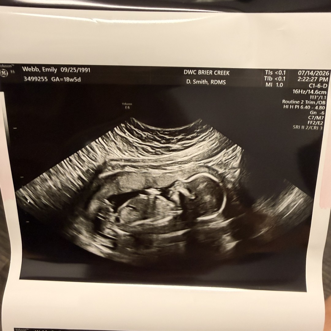 Photo shared by Emily for their Babylist baby registry.