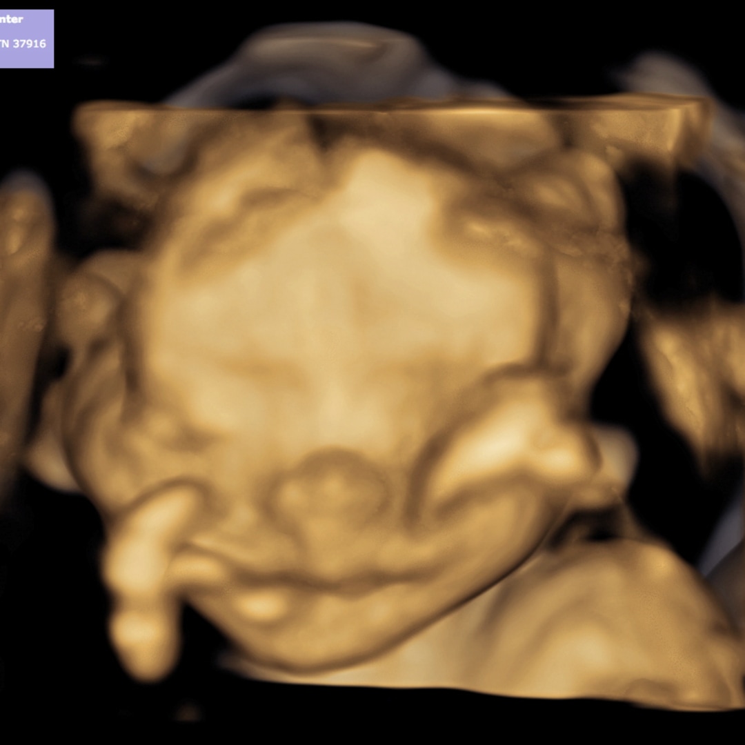 Photo shared by Taylor for their Babylist baby registry.