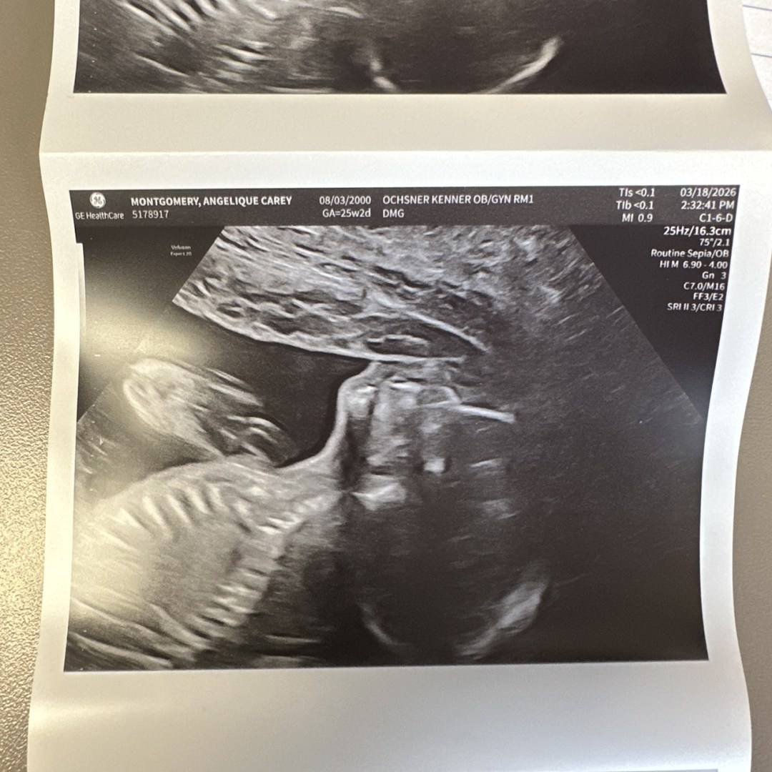 Photo shared by Angelique for their Babylist baby registry.