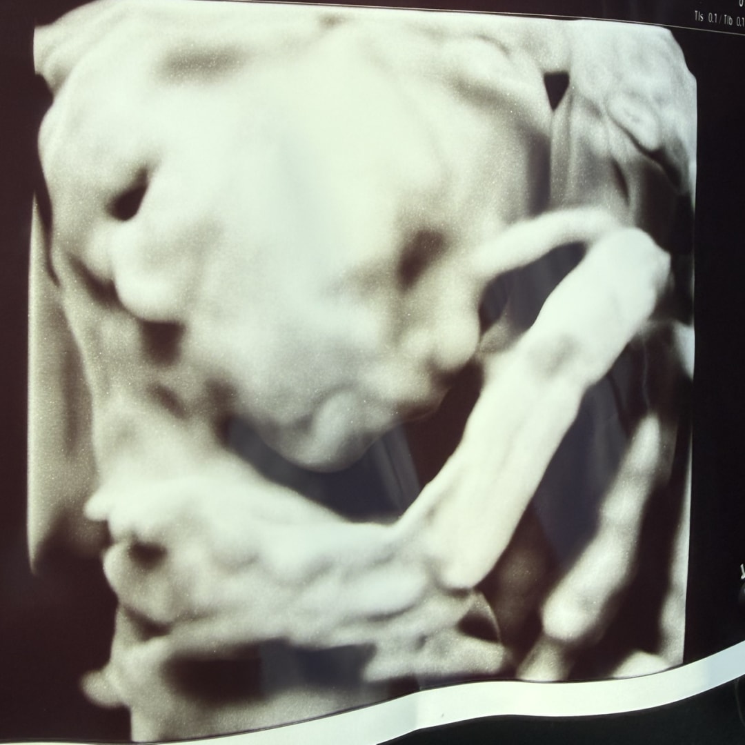 Photo shared by Megan for their Babylist baby registry.