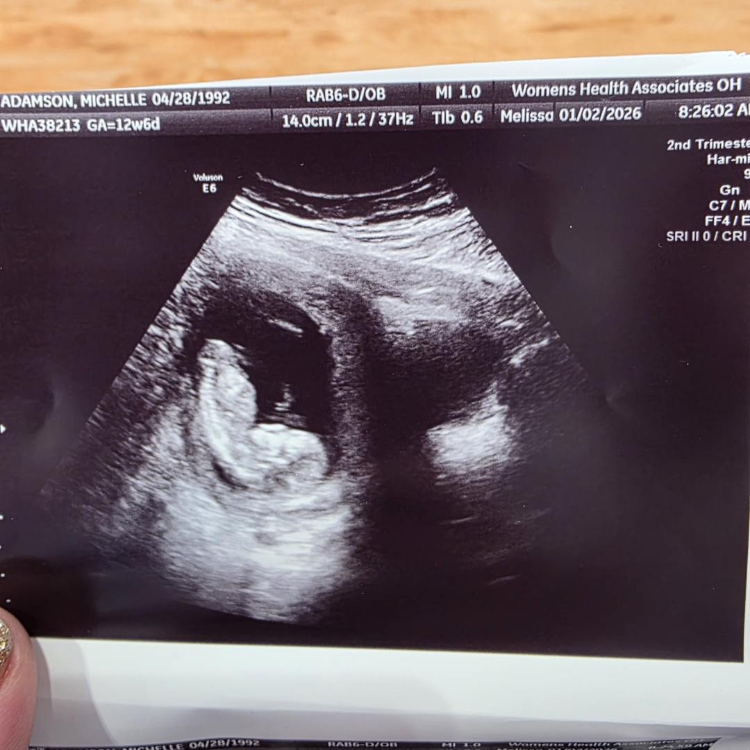 Photo shared by Michelle for their Babylist baby registry.