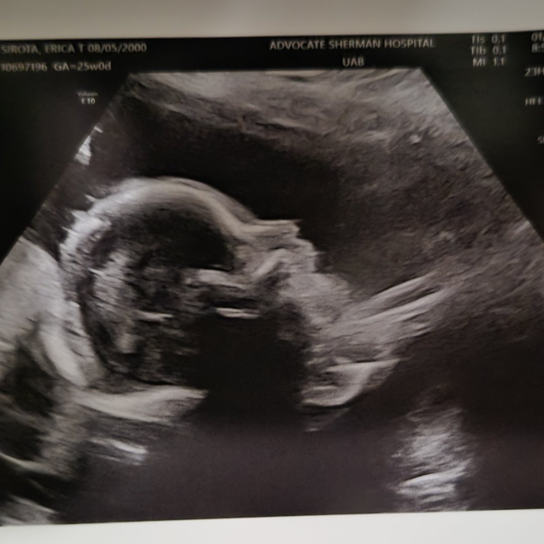 Photo shared by Dominic for their Babylist baby registry.