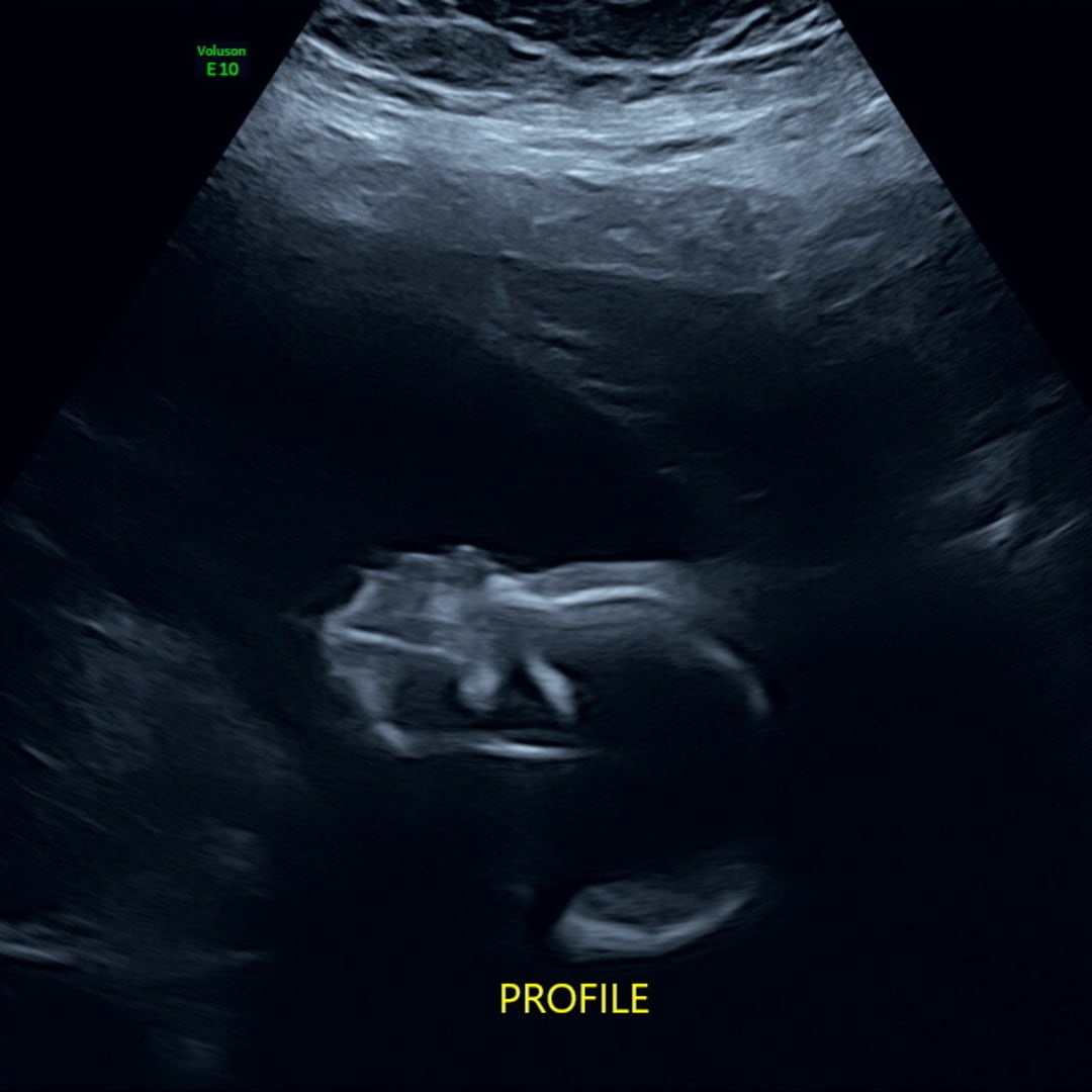 Photo shared by Tanala for their Babylist baby registry.