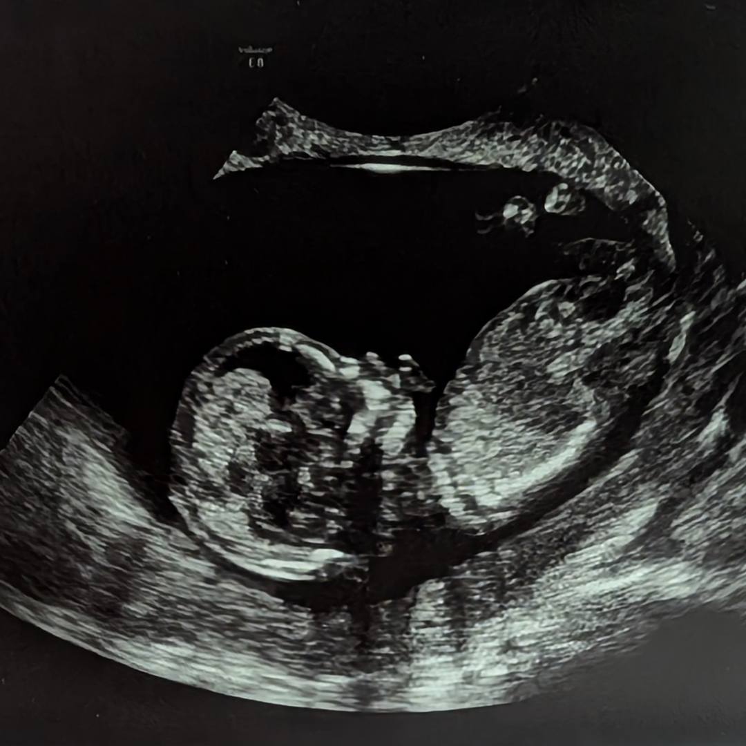 Photo shared by Patricia for their Babylist baby registry.
