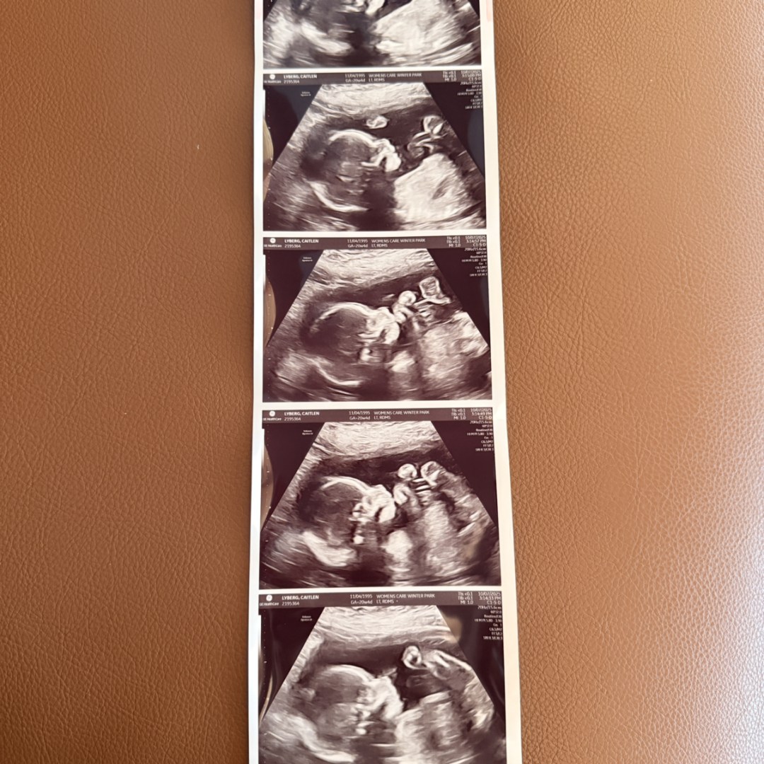 Photo shared by Caitlen for their Babylist baby registry.