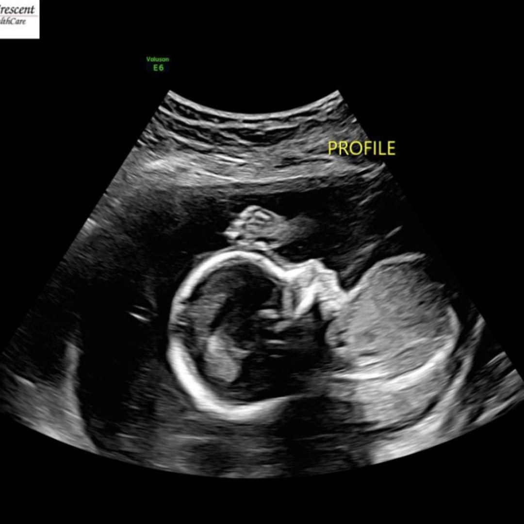 Photo shared by Payleigh for their Babylist baby registry.