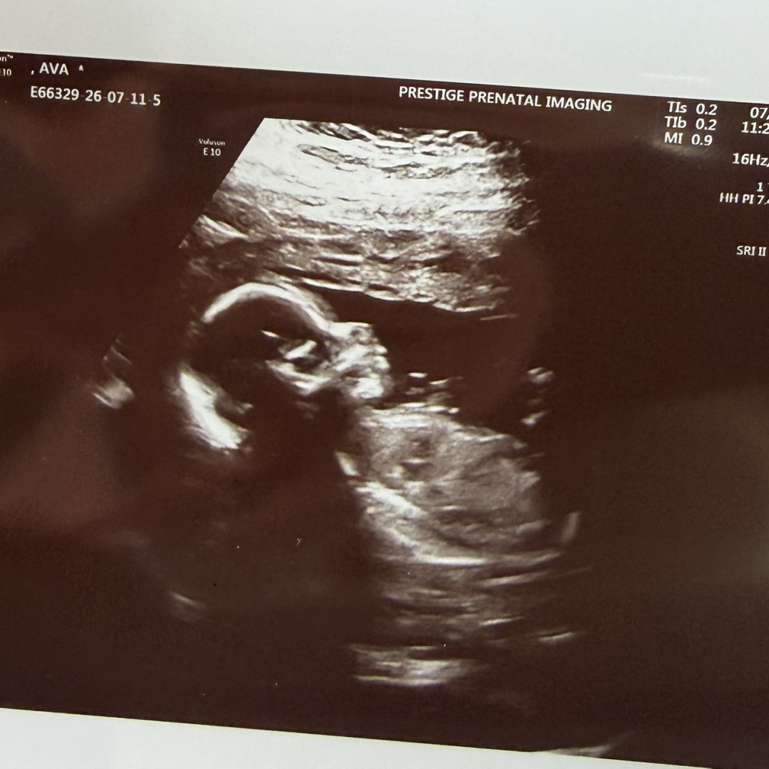Photo shared by Ava for their Babylist baby registry.