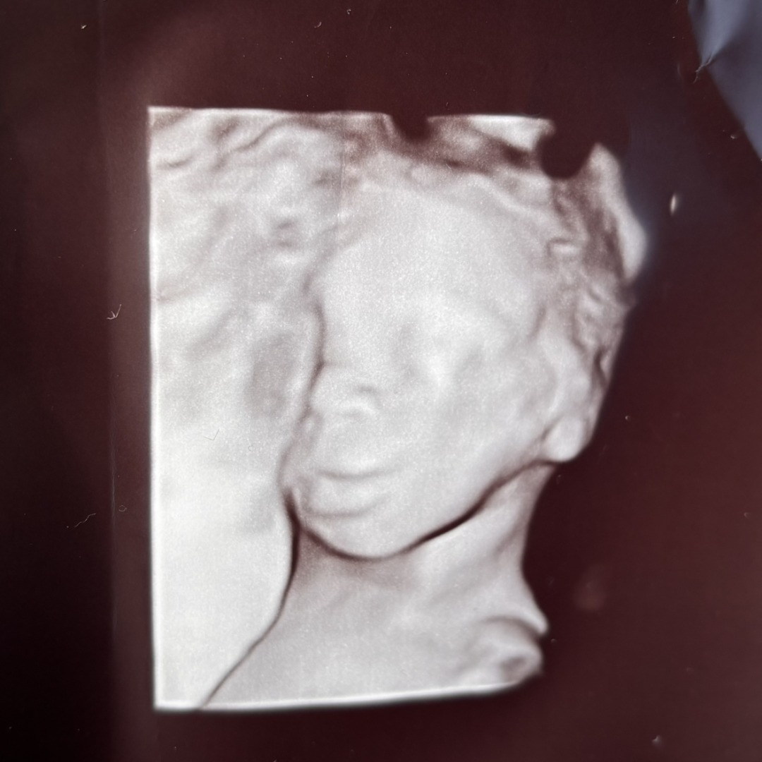 Photo shared by Jailynn for their Babylist baby registry.