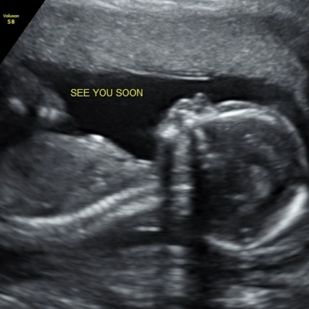 Photo shared by Brenda for their Babylist baby registry.