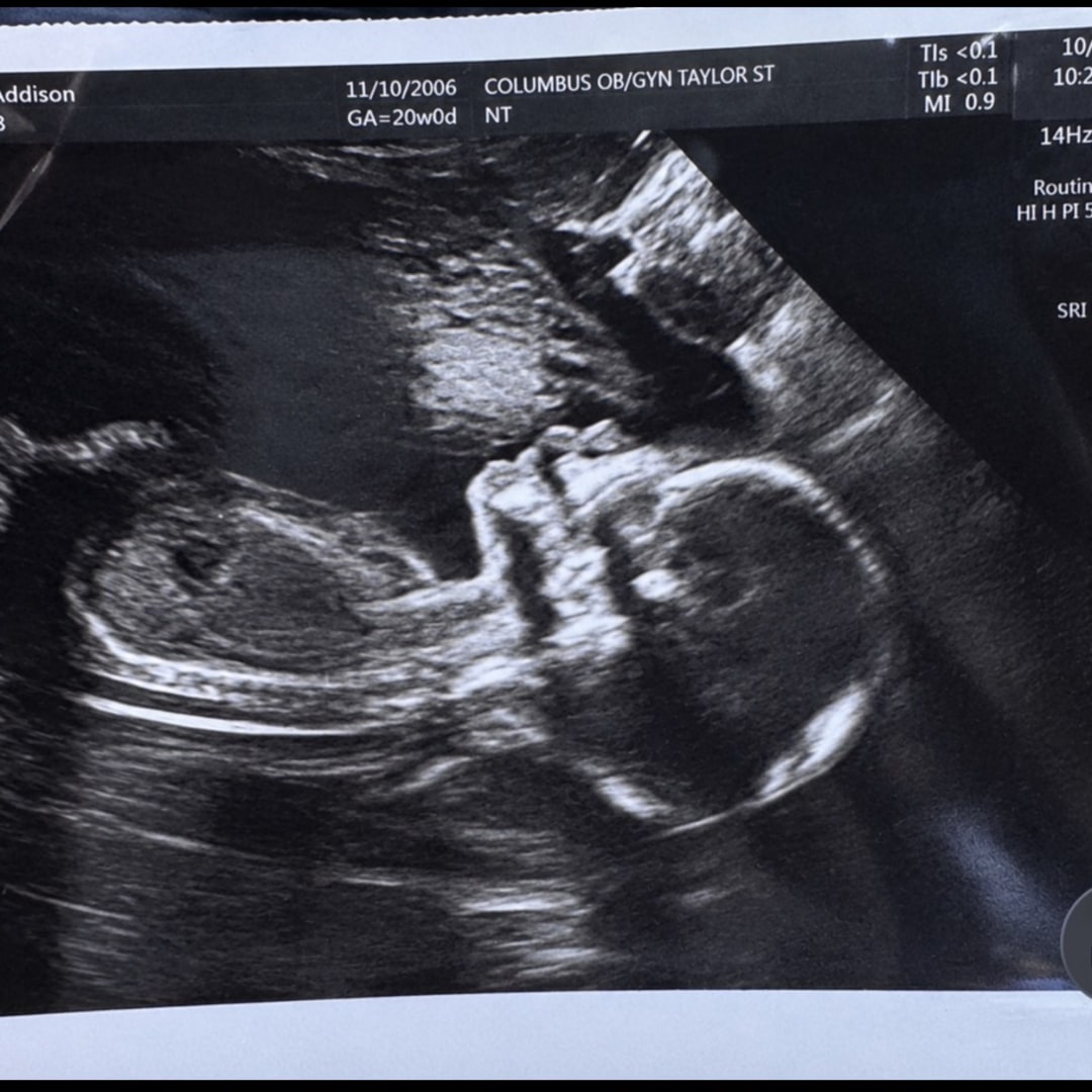 Photo shared by Addison for their Babylist baby registry.
