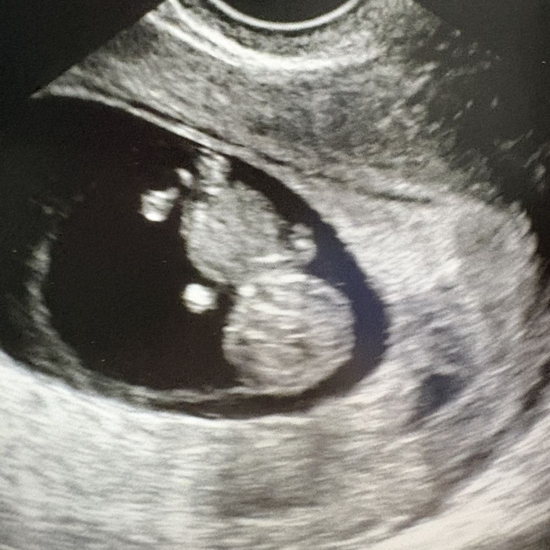 Photo shared by Nicole for their Babylist baby registry.