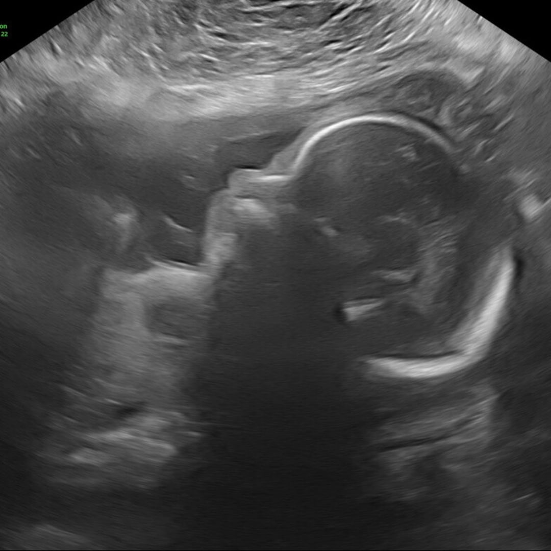 Photo shared by Liz for their Babylist baby registry.