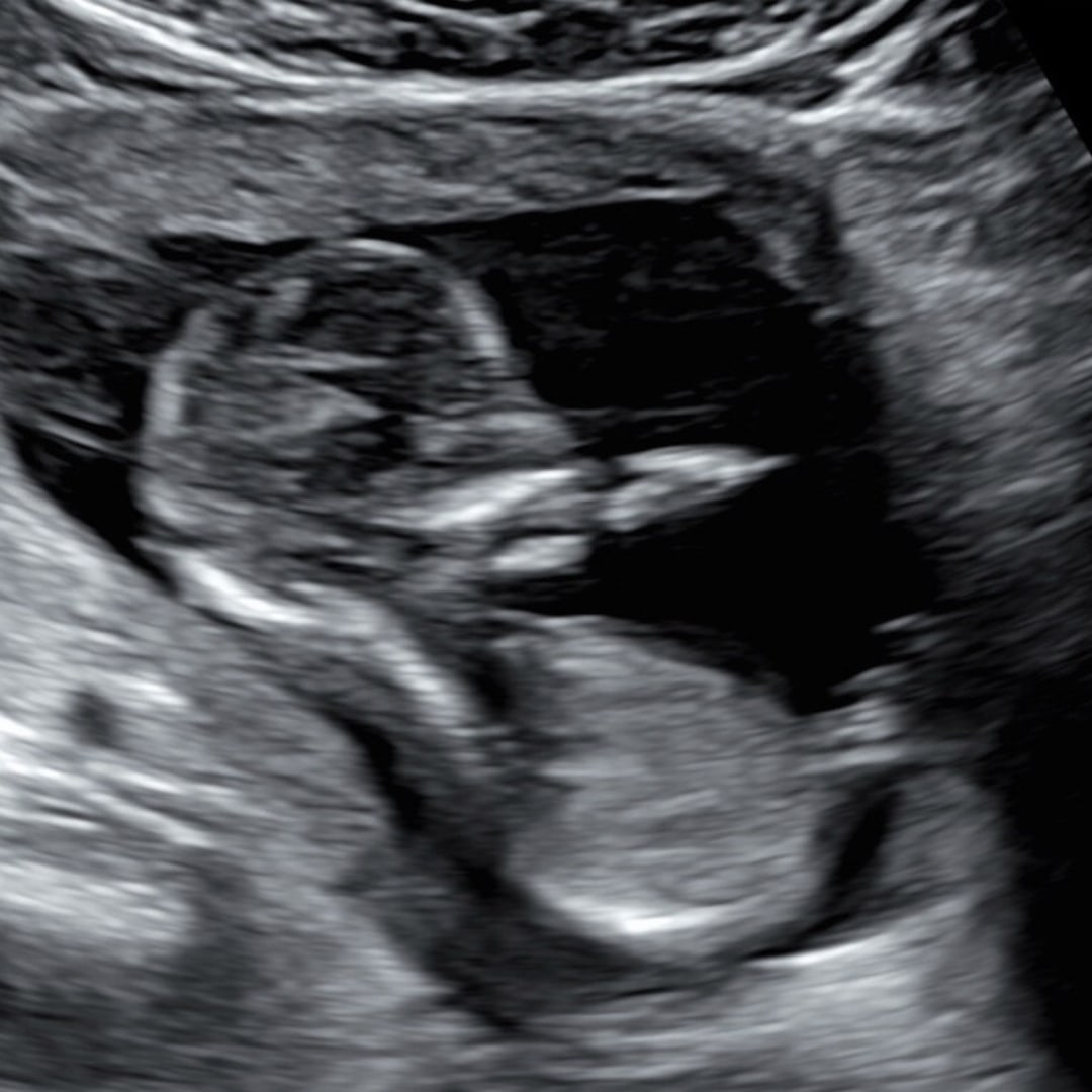 Photo shared by Chantelle for their Babylist baby registry.