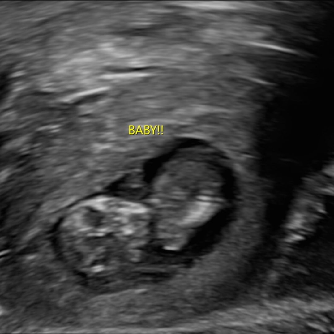 Photo shared by Katherine for their Babylist baby registry.