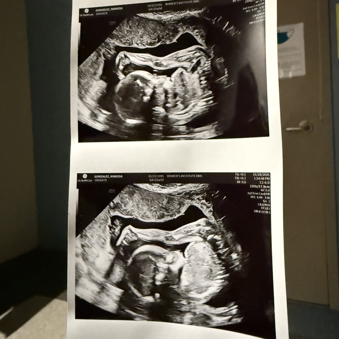 Photo shared by Marissa for their Babylist baby registry.