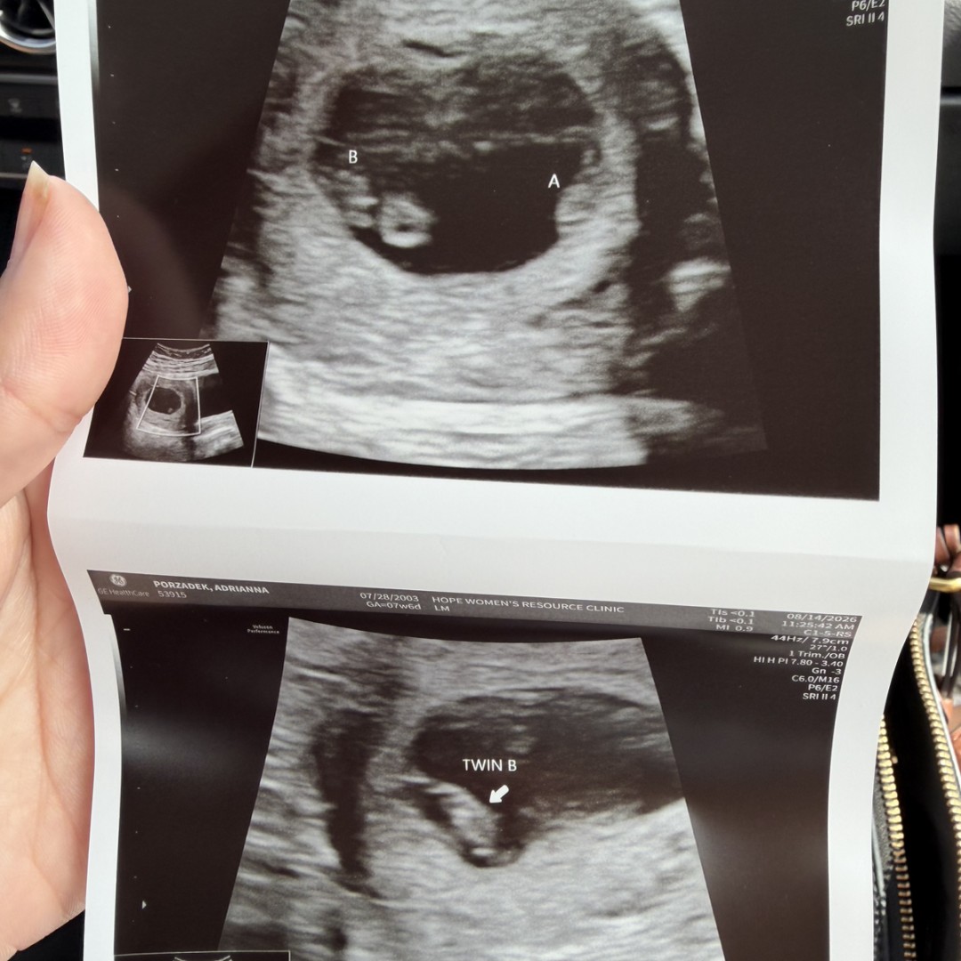 Photo shared by Adrianna for their Babylist baby registry.