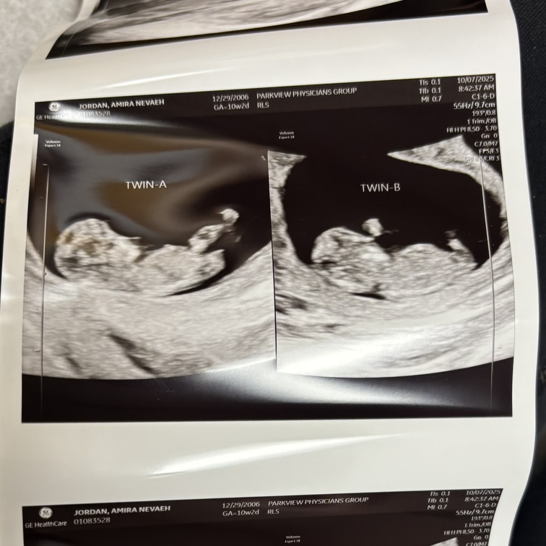 Photo shared by Amira for their Babylist baby registry.