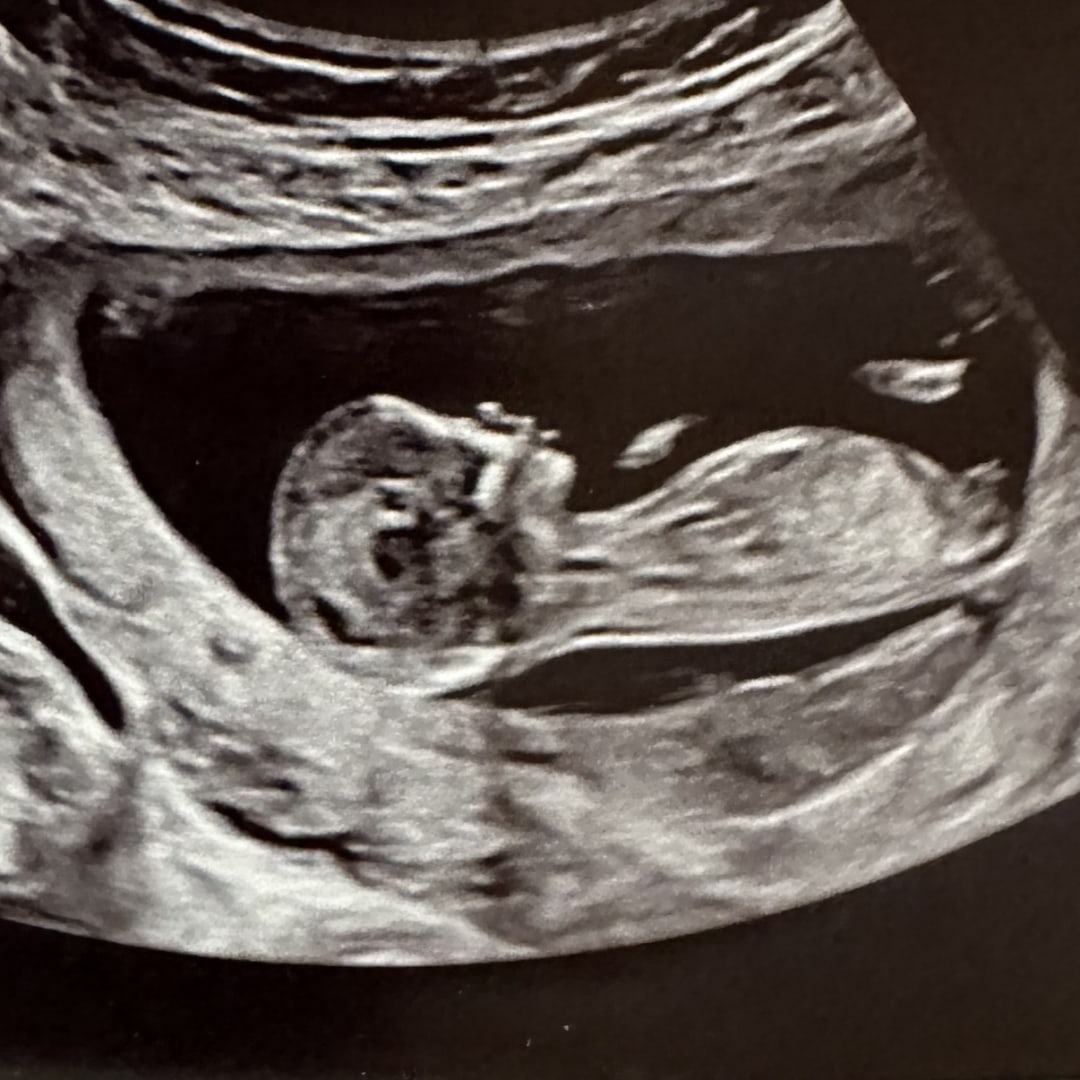 Photo shared by Tori for their Babylist baby registry.