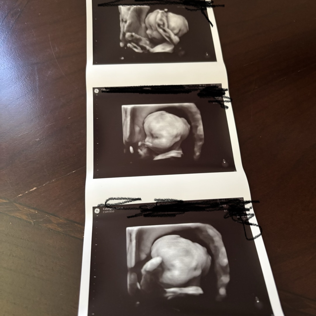 Photo shared by Susan for their Babylist baby registry.