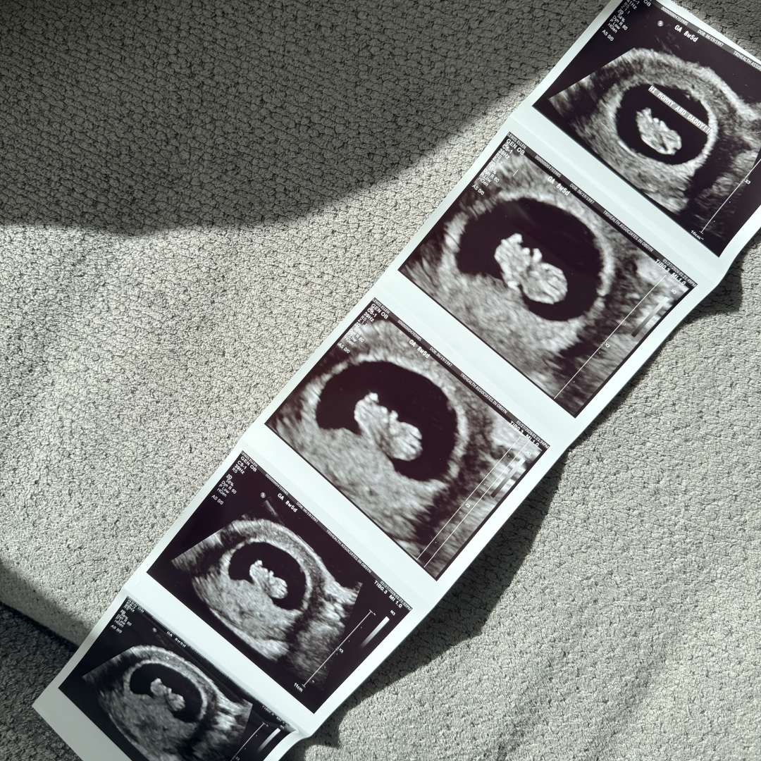 Photo shared by Ellen for their Babylist baby registry.