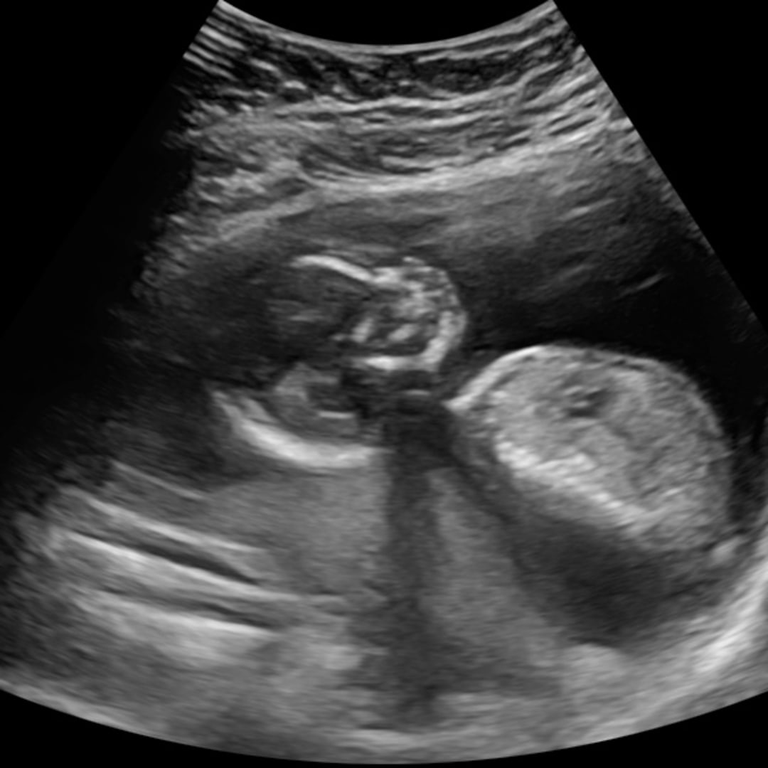 Photo shared by Macey for their Babylist baby registry.