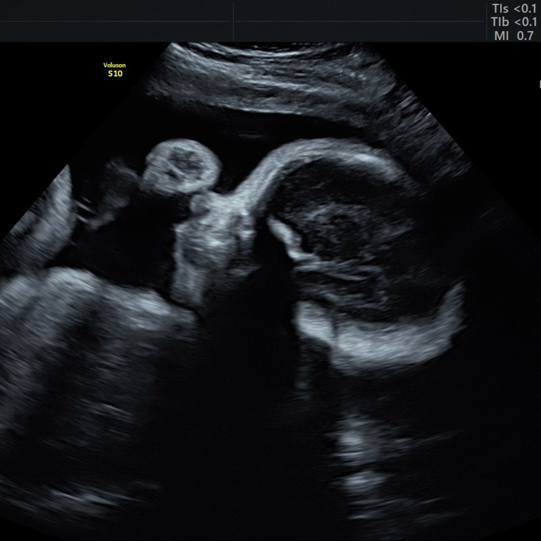 Photo shared by Kristine for their Babylist baby registry.