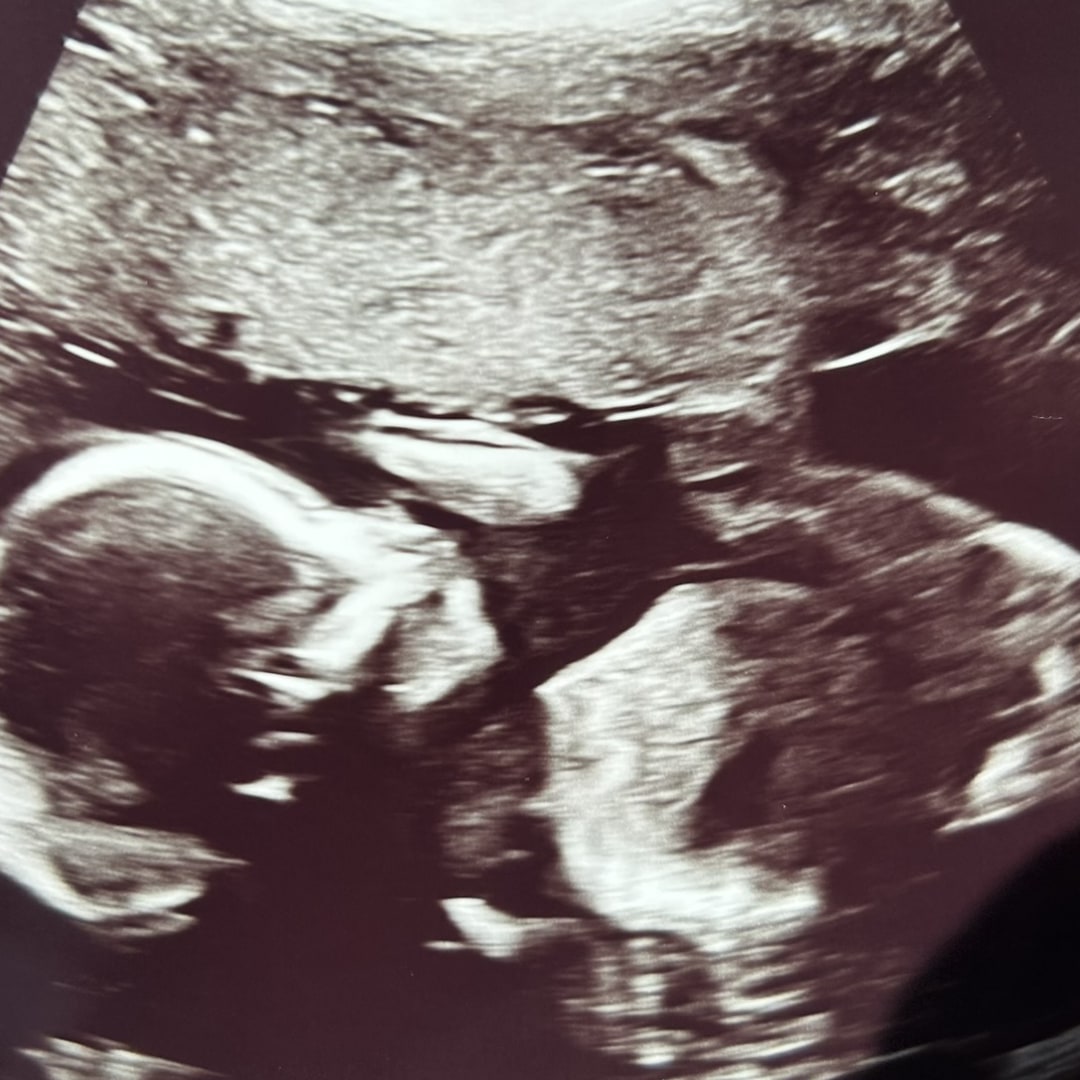 Photo shared by Jillian for their Babylist baby registry.