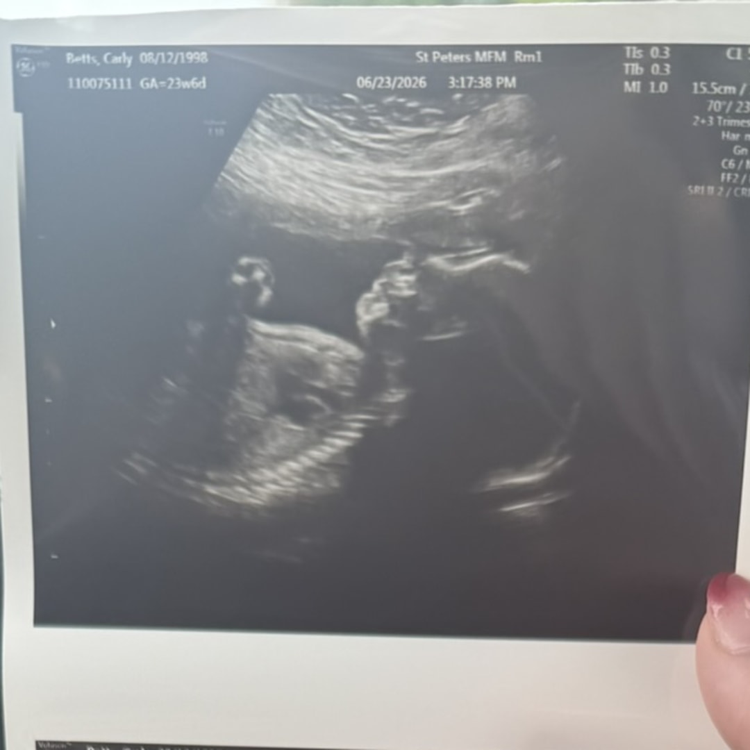 Photo shared by Carly for their Babylist baby registry.
