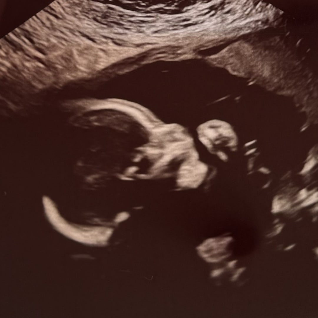 Photo shared by Sarah for their Babylist baby registry.