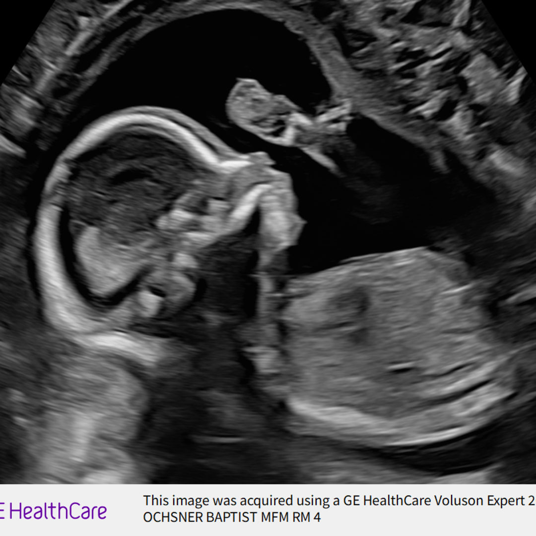 Photo shared by Alexis for their Babylist baby registry.