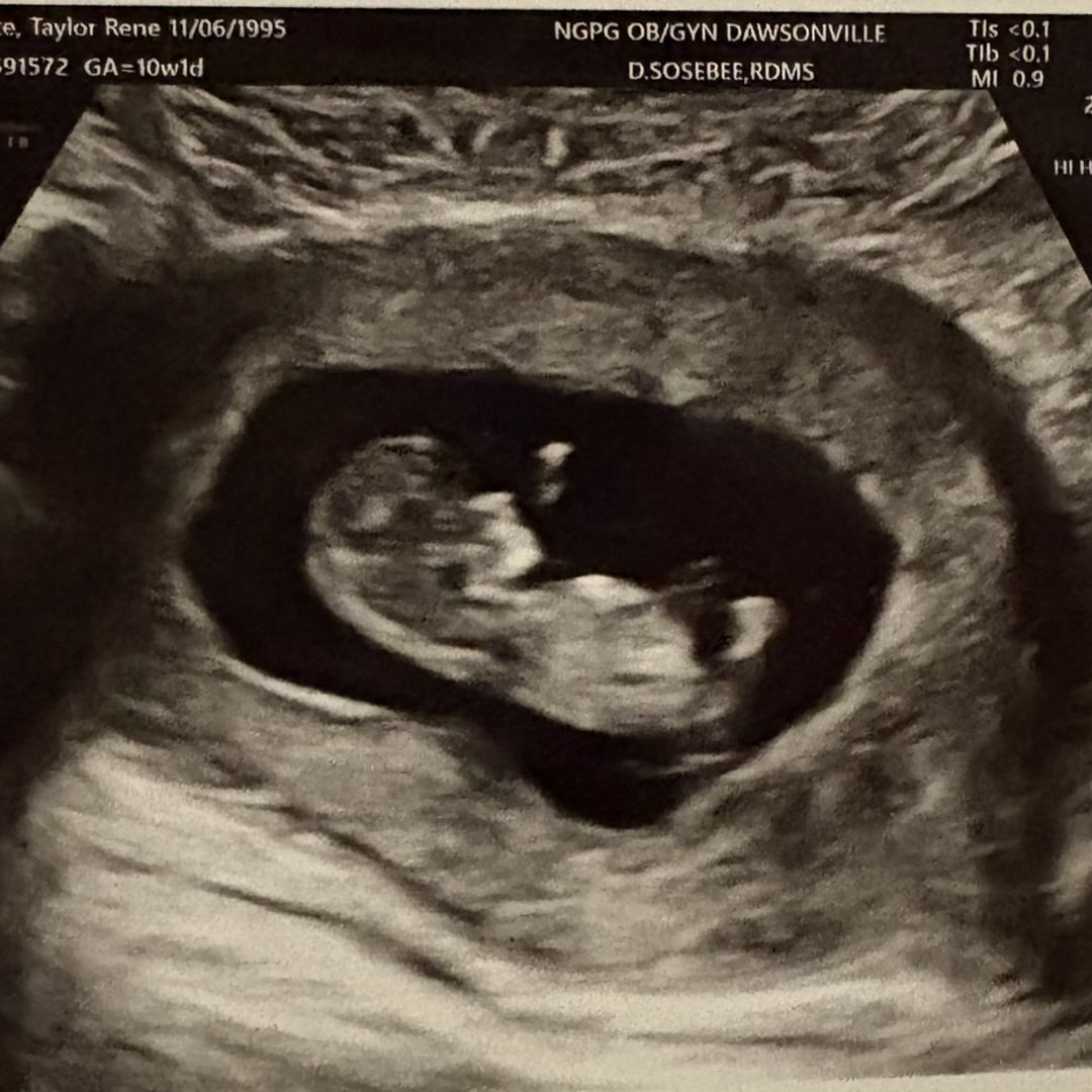 Photo shared by Taylor for their Babylist baby registry.