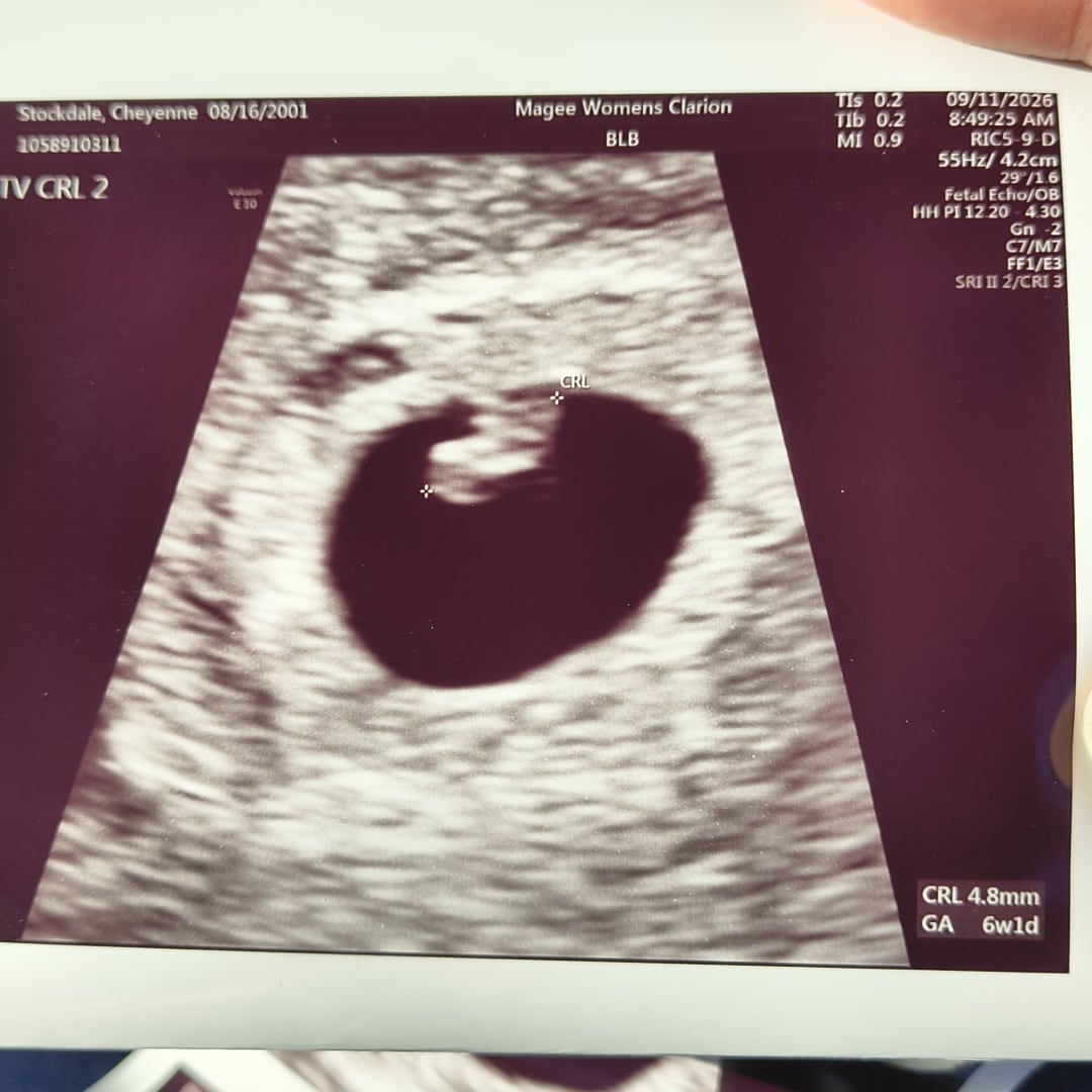 Photo shared by Cheyenne for their Babylist baby registry.