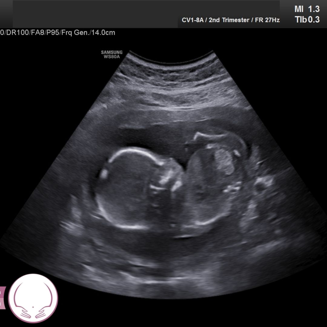 Photo shared by Abby for their Babylist baby registry.