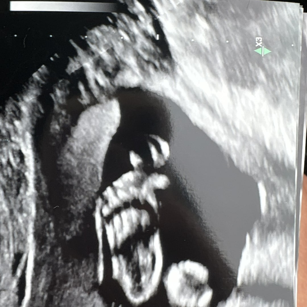 Photo shared by Daphne for their Babylist baby registry.