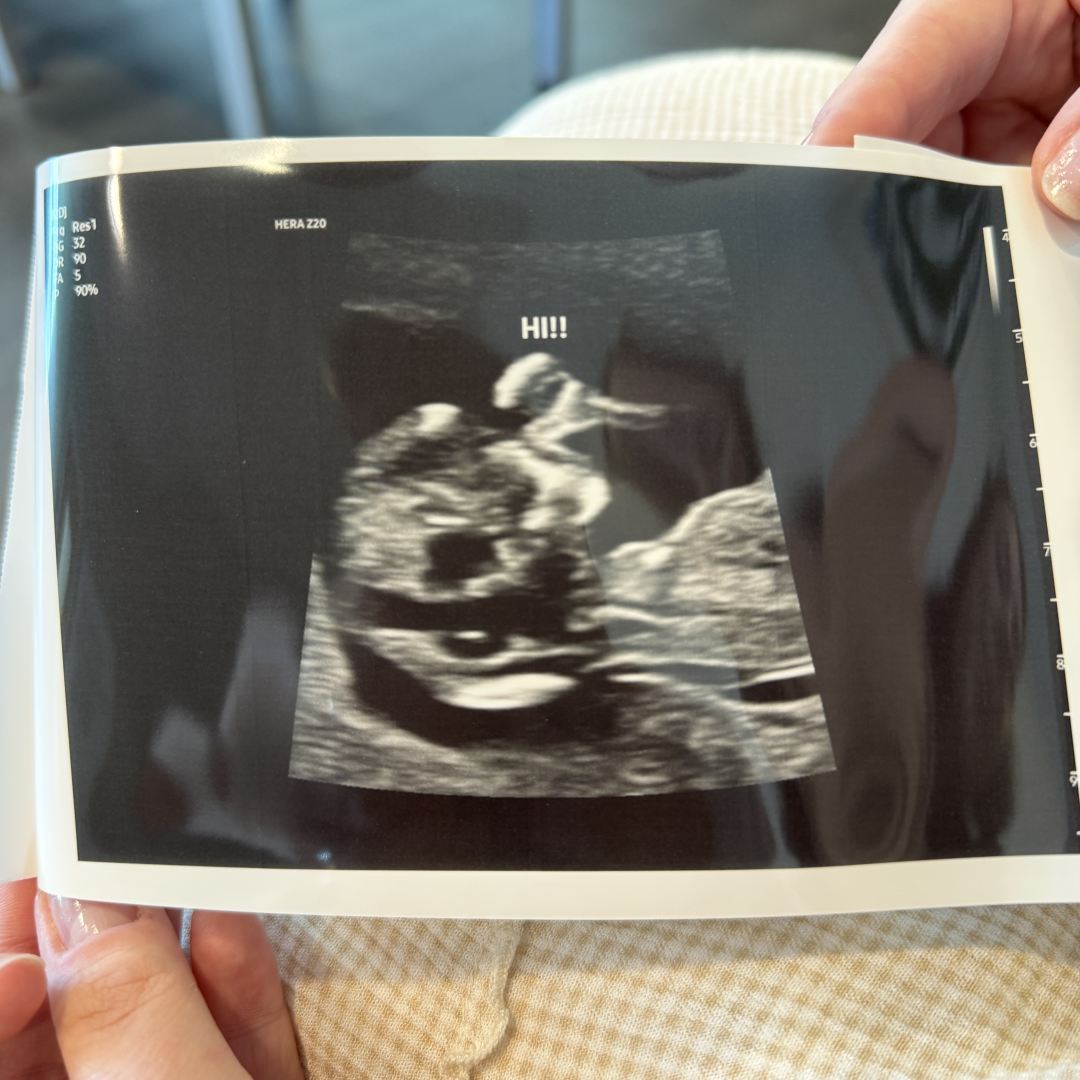 Photo shared by Jamie for their Babylist baby registry.