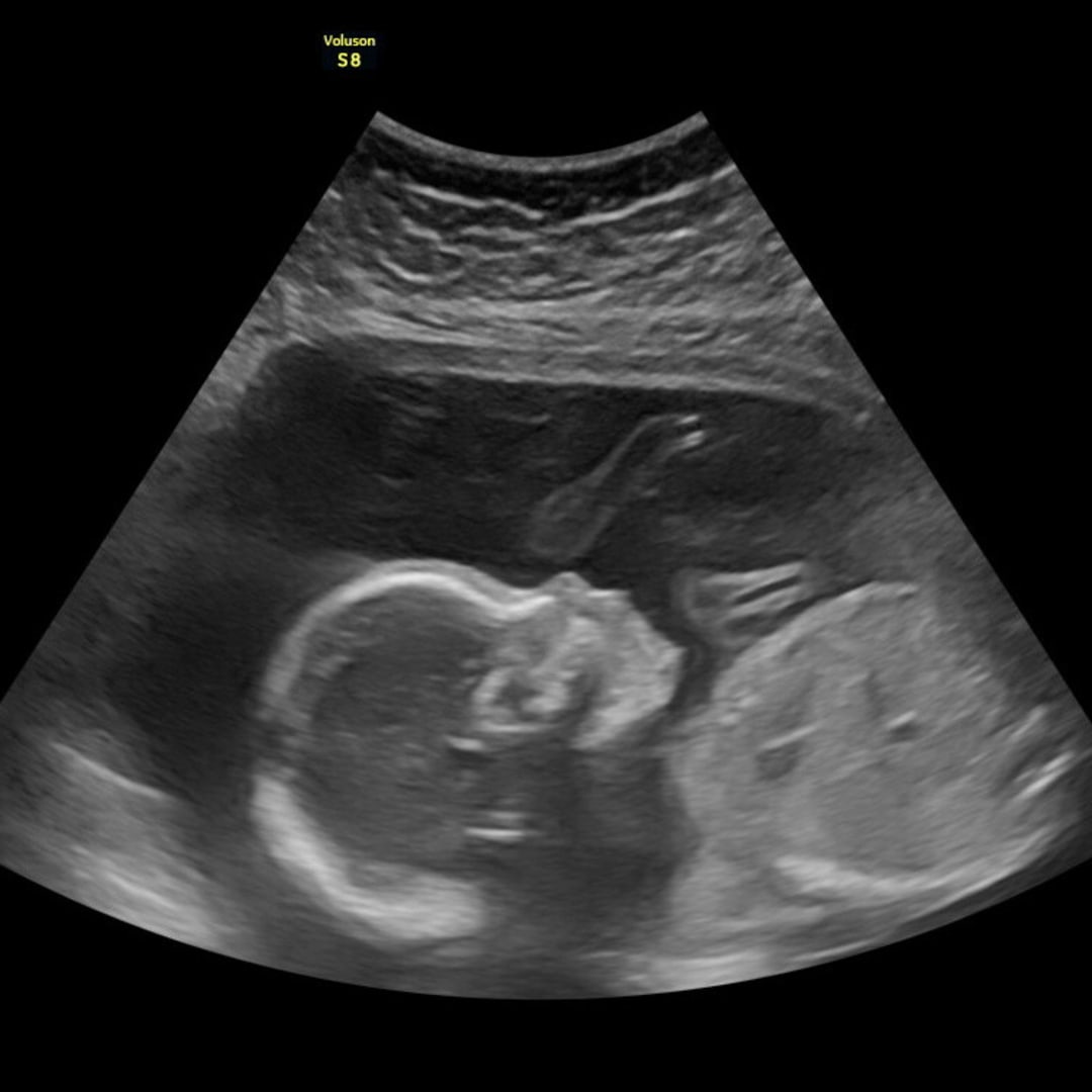 Photo shared by Briona for their Babylist baby registry.