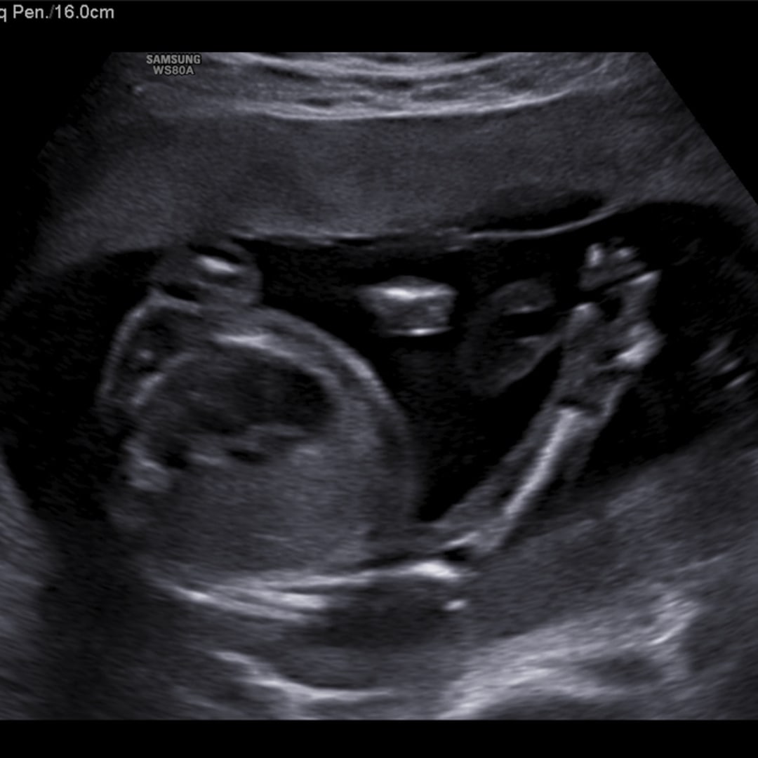 Photo shared by Adriana for their Babylist baby registry.