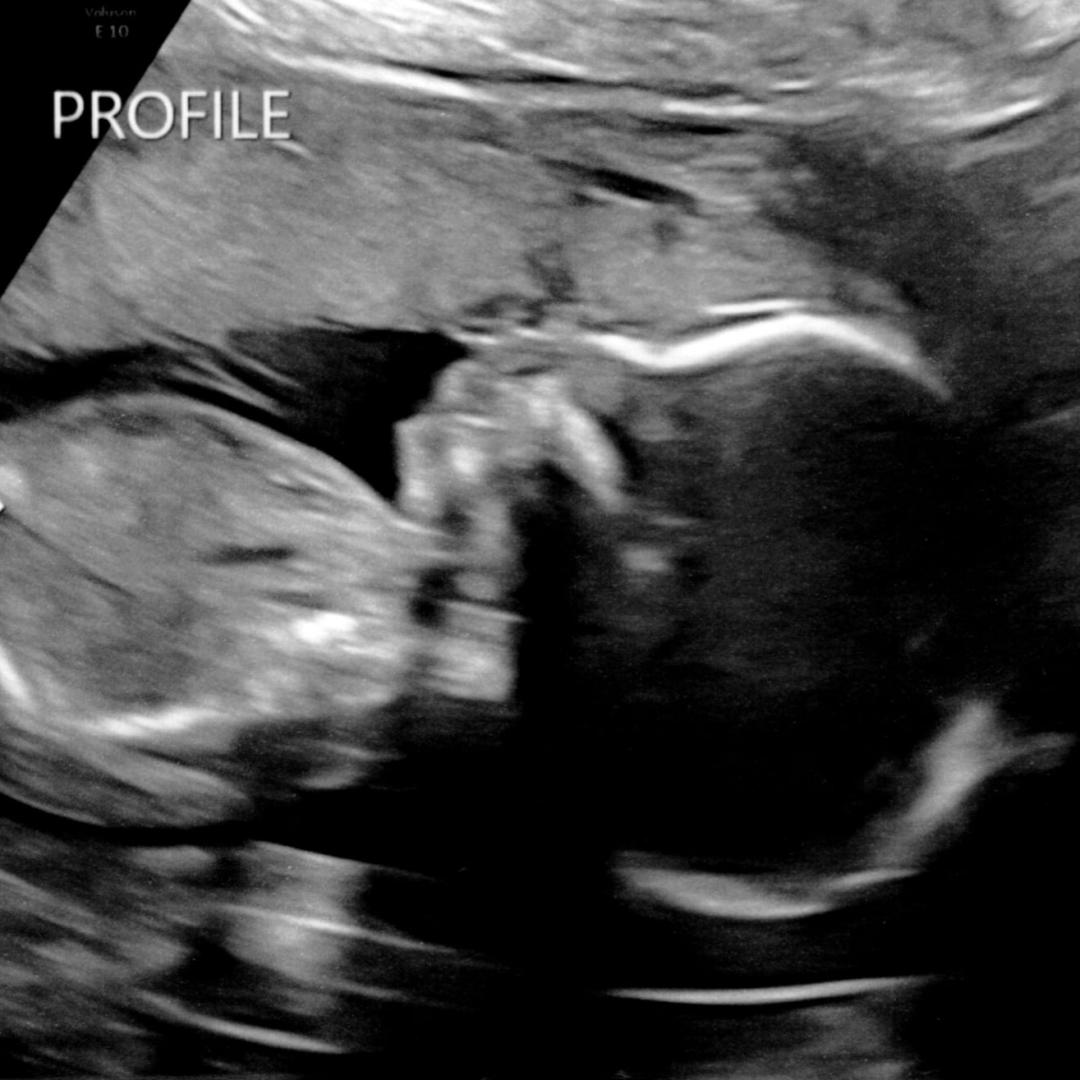 Photo shared by Christina for their Babylist baby registry.