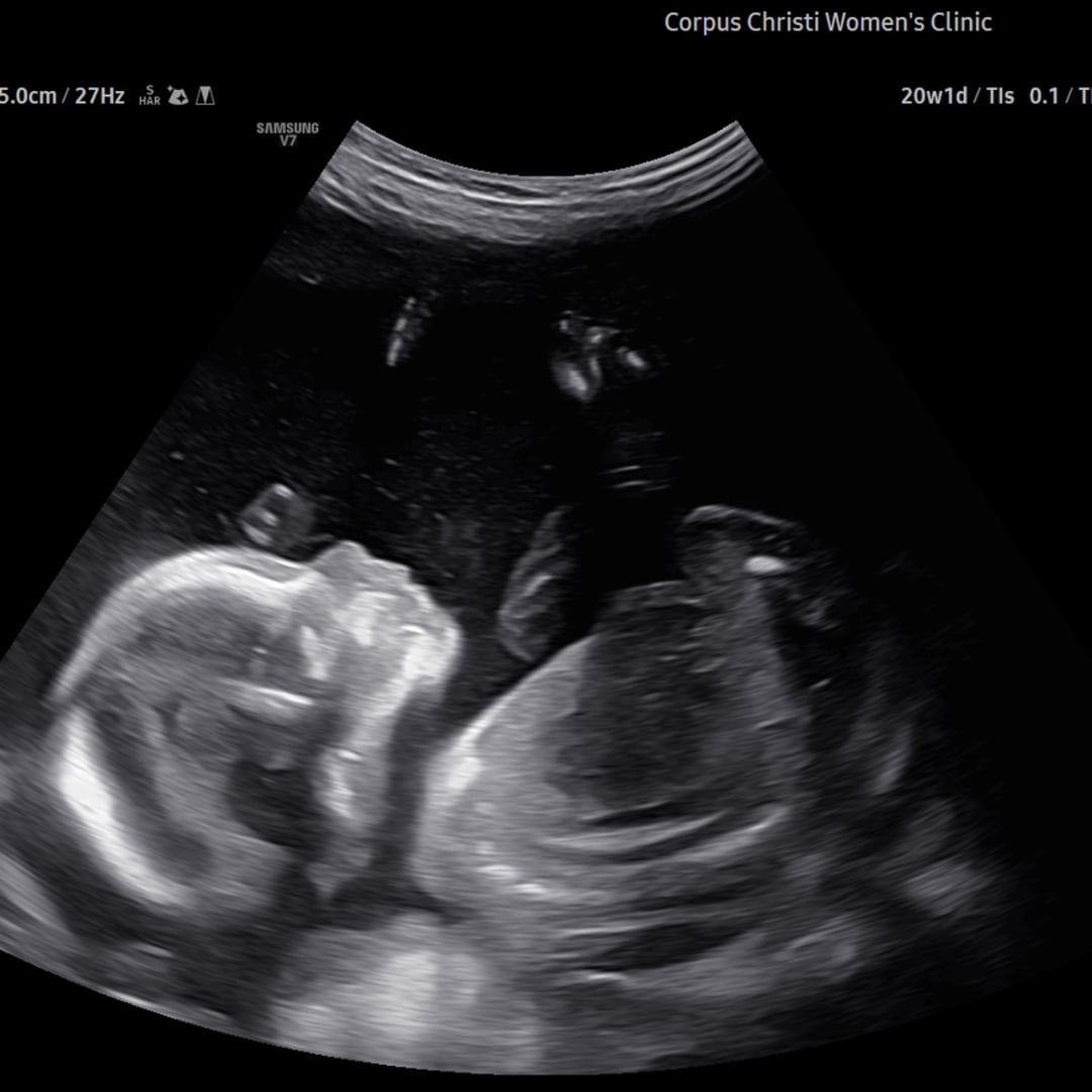 Photo shared by Sarah for their Babylist baby registry.