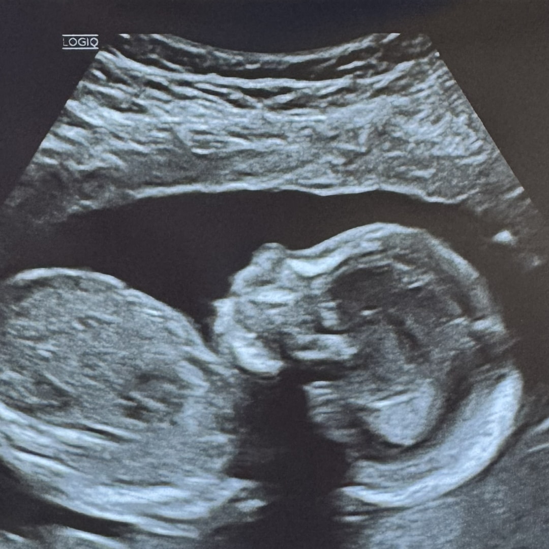Photo shared by Hanna for their Babylist baby registry.