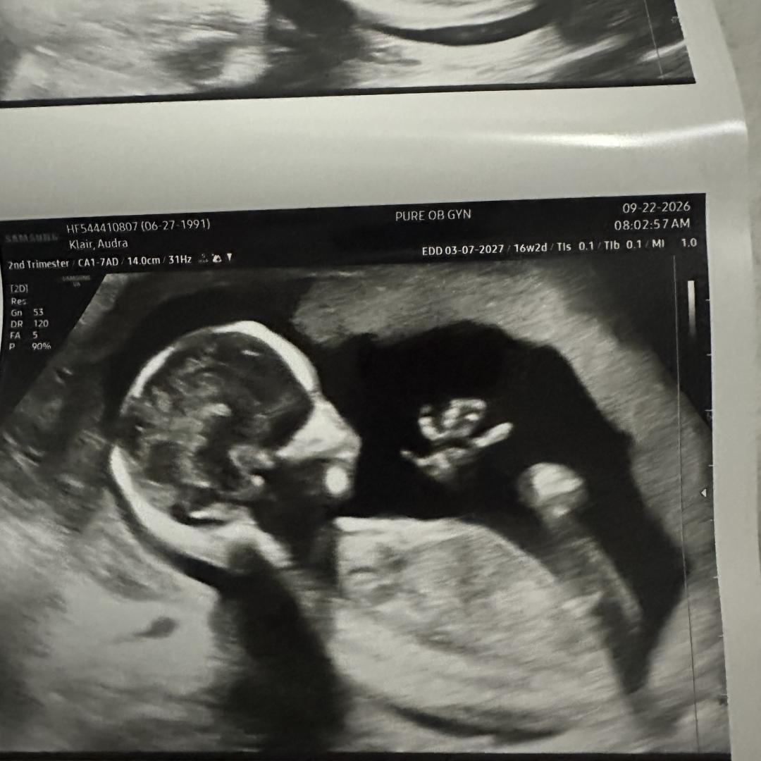 Photo shared by Audra for their Babylist baby registry.