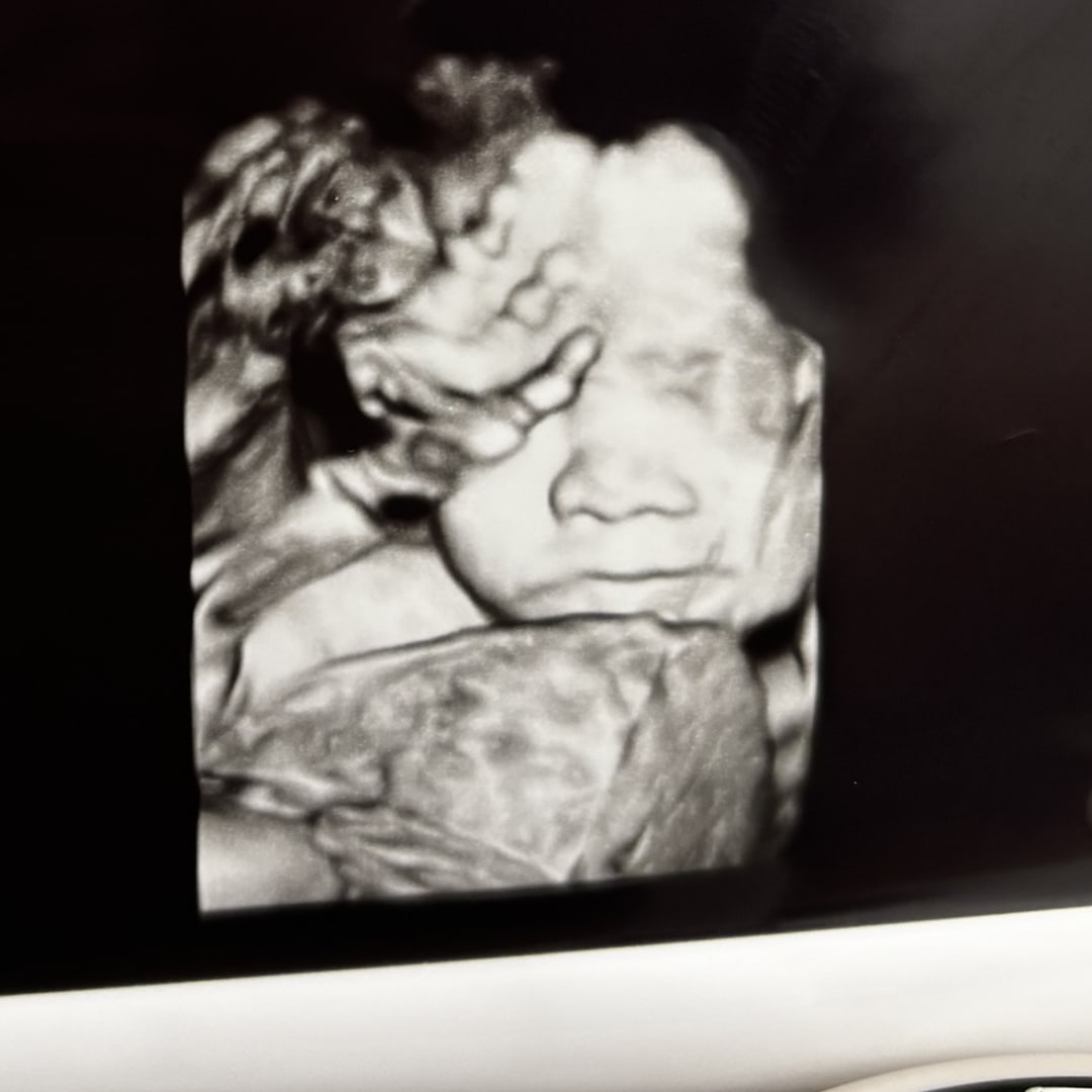 Photo shared by Melani for their Babylist baby registry.