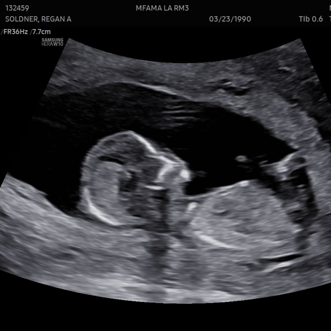 Photo shared by Regan for their Babylist baby registry.