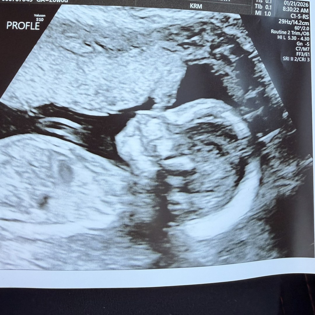 Photo shared by Rachel for their Babylist baby registry.