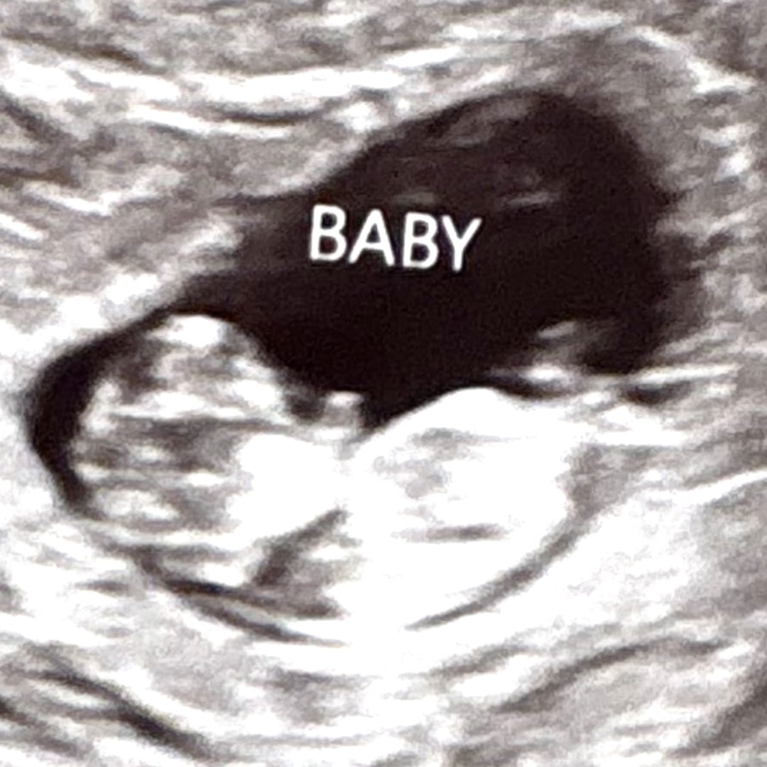 Photo shared by Colbey for their Babylist baby registry.