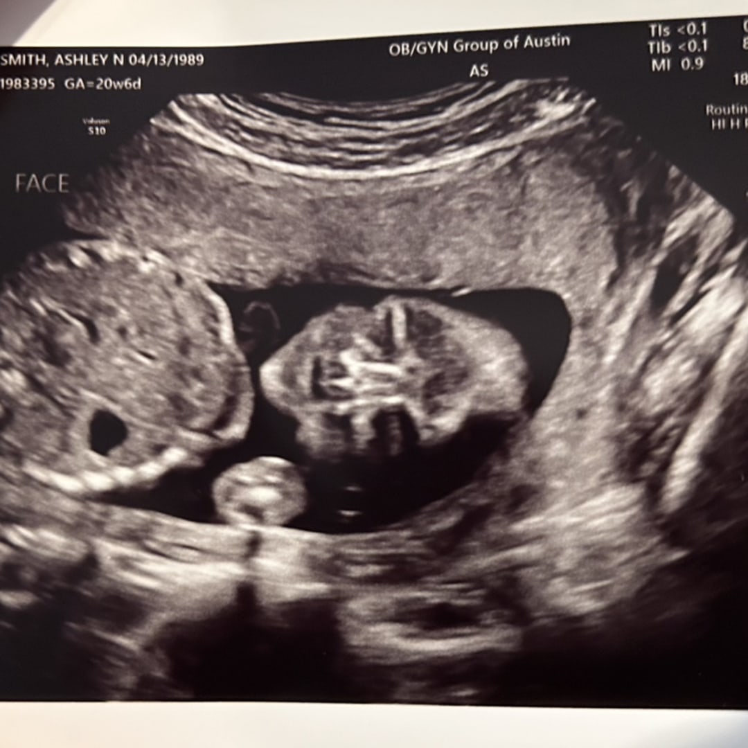 Photo shared by Ashley for their Babylist baby registry.