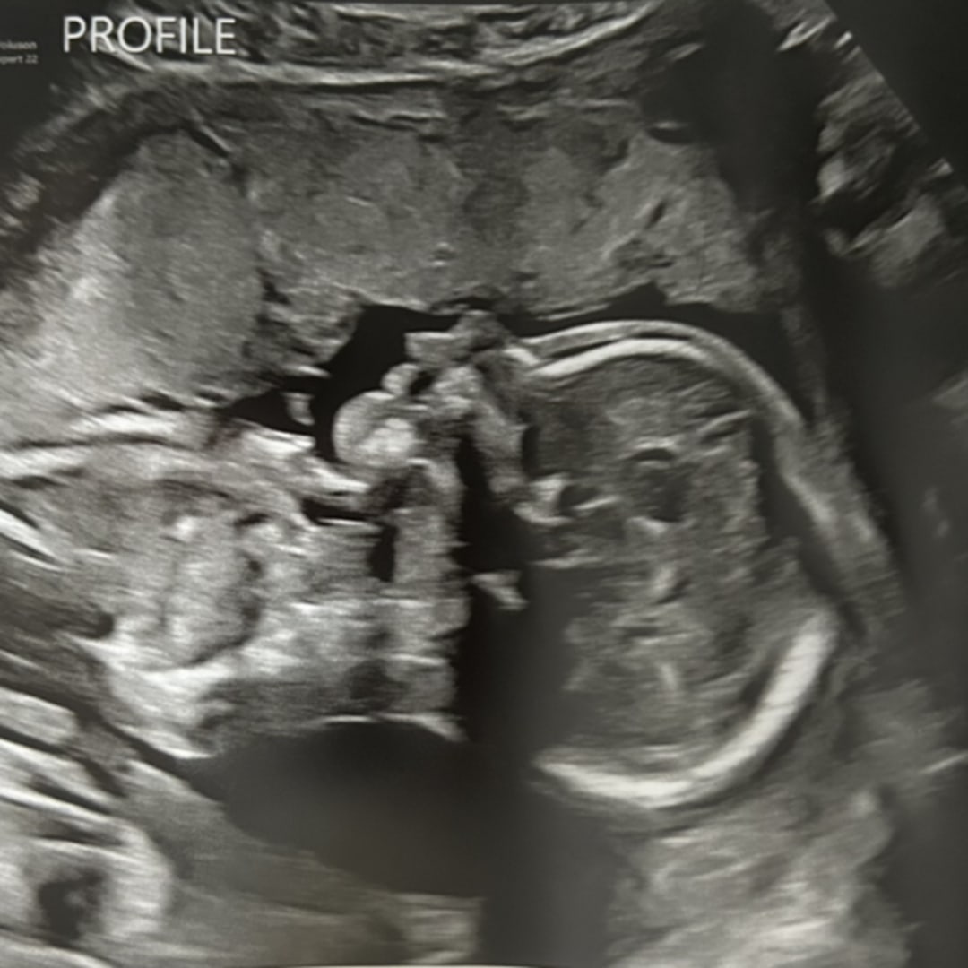 Photo shared by Gabrielle for their Babylist baby registry.