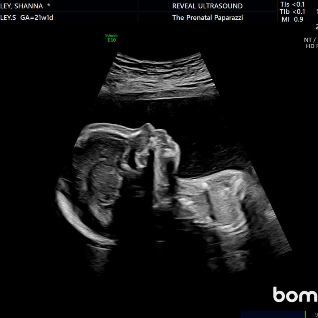 Photo shared by Shanna for their Babylist baby registry.