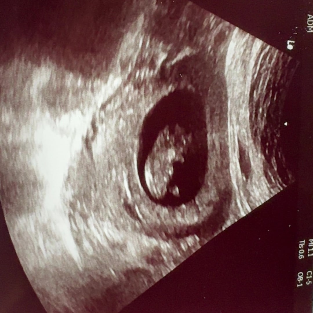 Photo shared by Danielle for their Babylist baby registry.