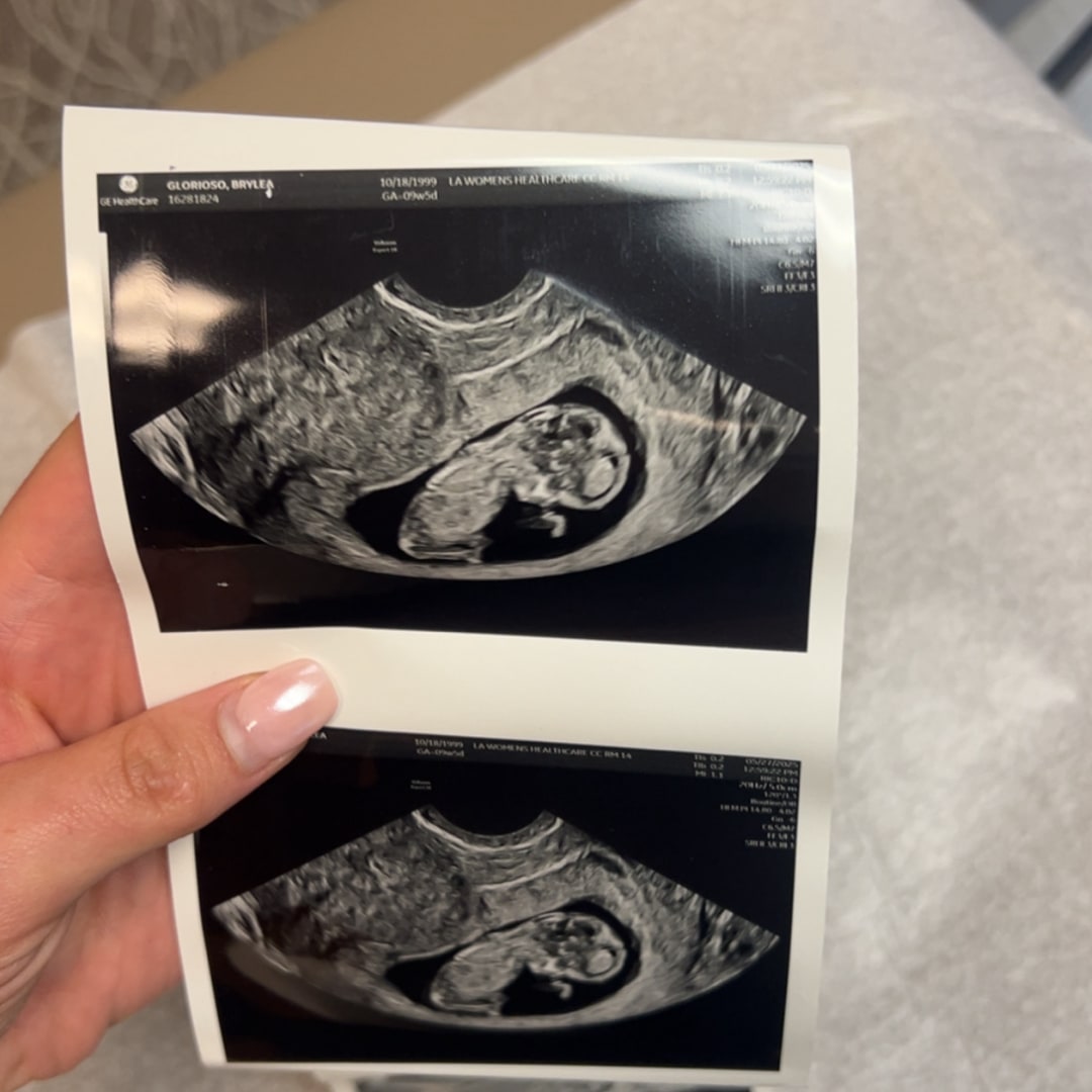 Photo shared by Brylea for their Babylist baby registry.